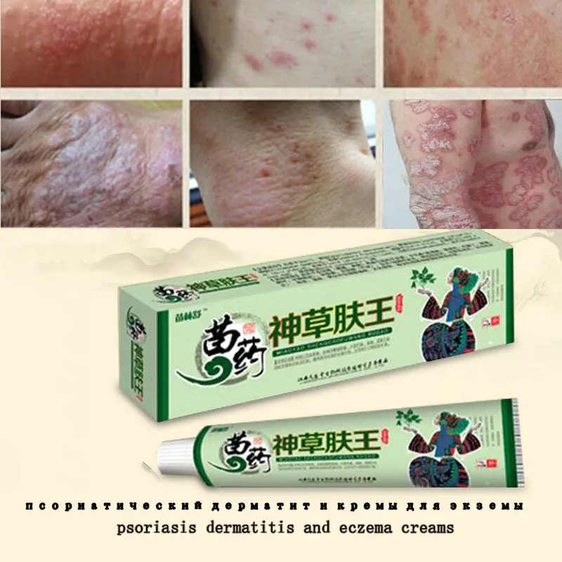 

100% Natural Herbal Creams Body Psoriasis Cream Perfect For Dermatitis and Eczema Pruritus Psoriasis Skin Problem Plaster