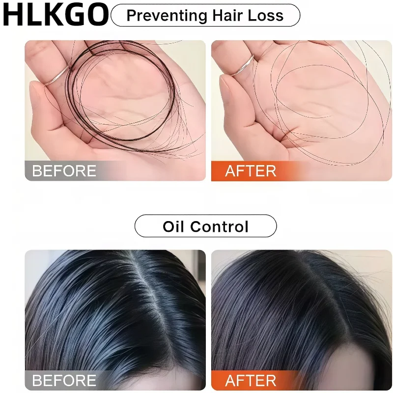 

Терапевтическая шапочка красного света, 80 шт., 665 нм, устройство для роста волос ближнего инфракрасного цвета для против выпадения волос и ухода за кожей головы