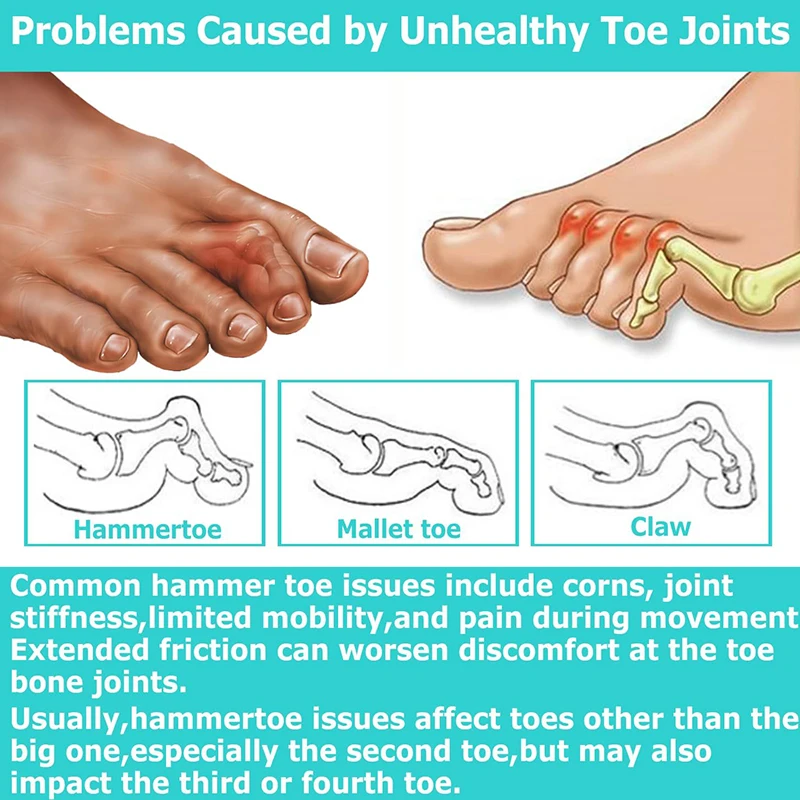 Pexmen 2/4Pcs Soft Gel Toe Separators Toe Spacers Bunion Corrector for Overlapping Hallux Valgus and Hammertoe Foot Care Tool