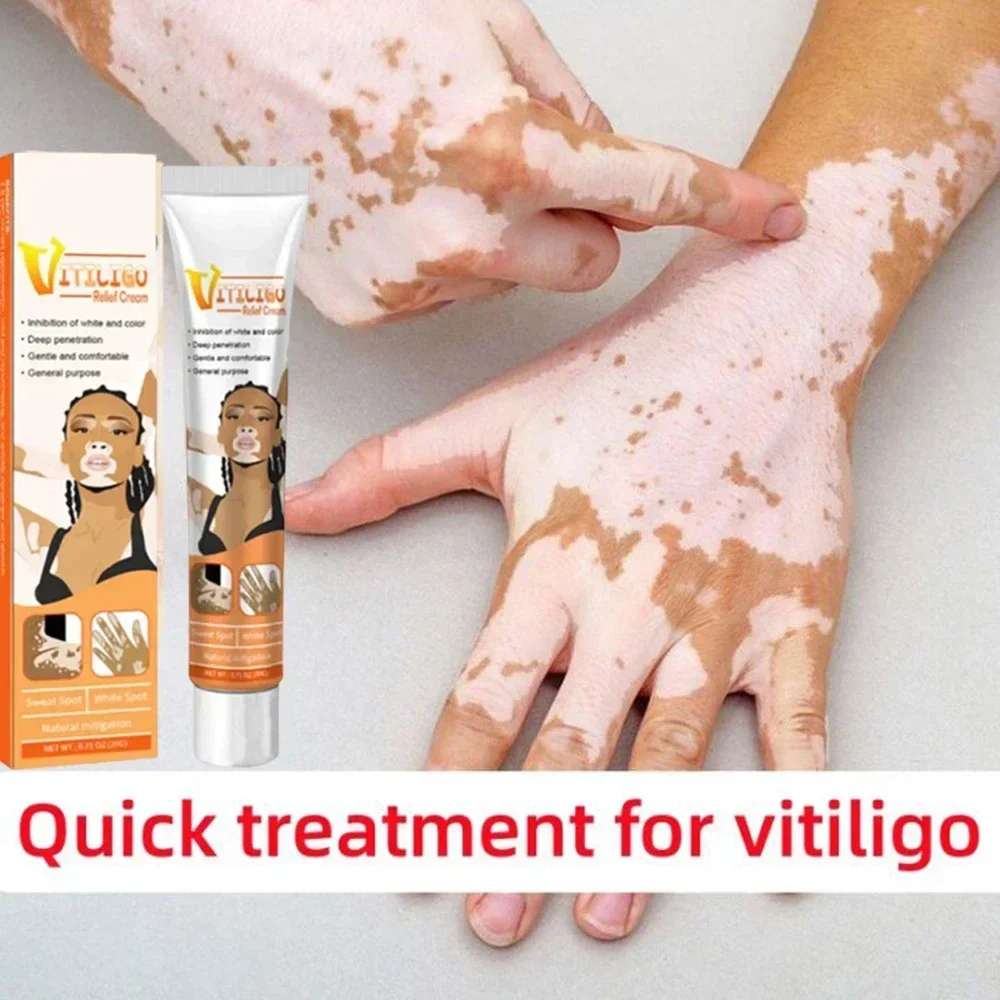 

Vitiligo Ointment Ringworm Effectively Remove White Spot Removal Skin Vitiligo Eliminate Vitiligo Body Skin Care 1006