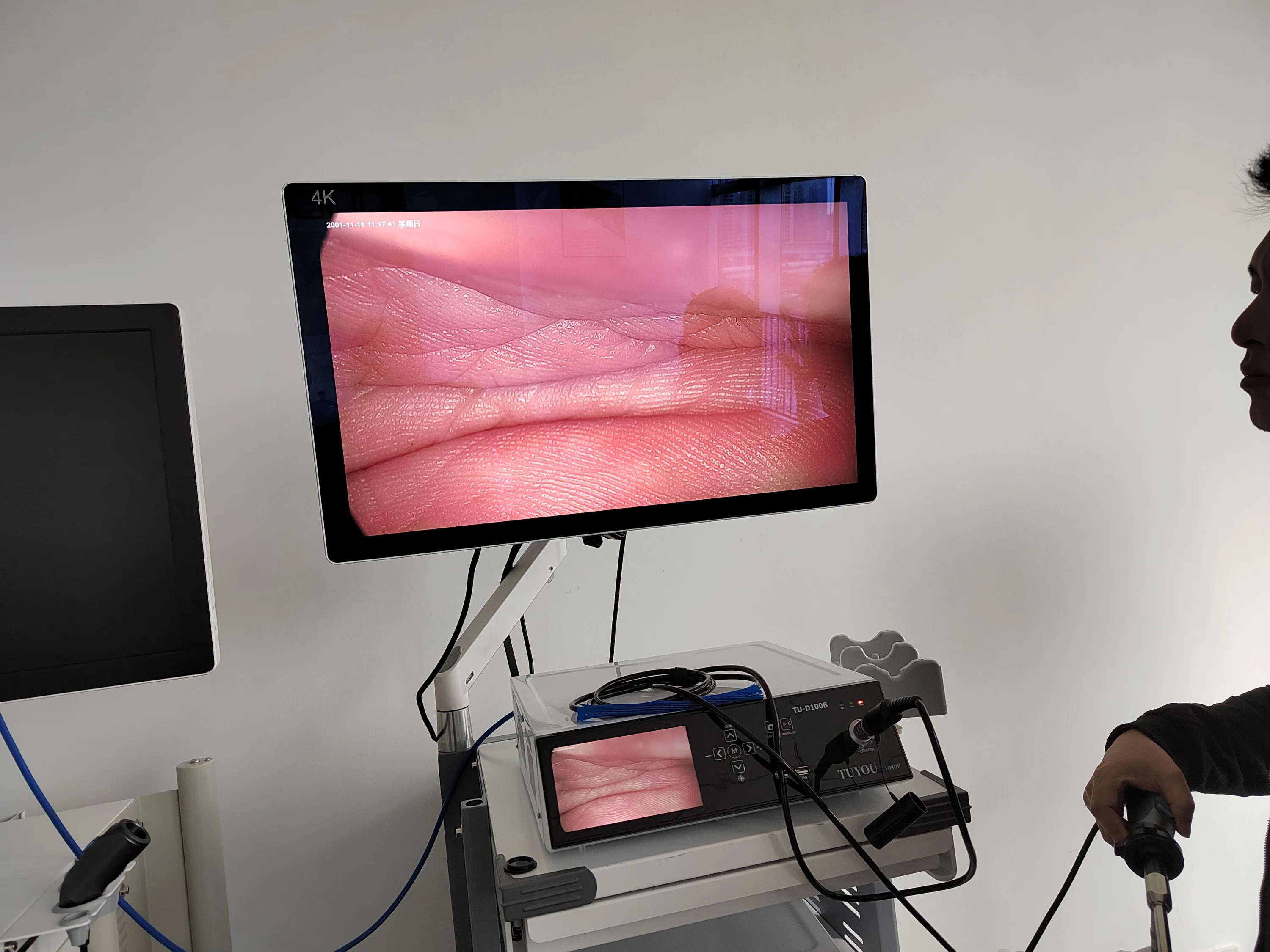 Medical Endoscope Camera System Endoscopy Camera for Arthroscopy Laparoscopy ENT Endoscope Camera Tower