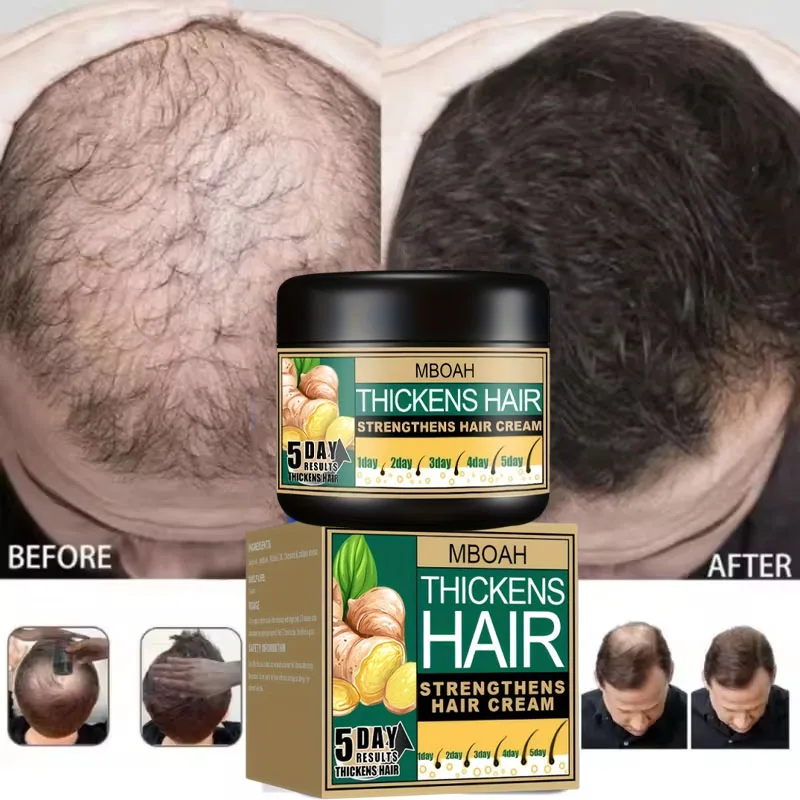 

Крем для роста волос, 7 дней, необходимые капсулы для быстрого восстановления волос, против выпадения волос, восстановление облысения, лечение поврежденной кожи головы для женщин и мужчин