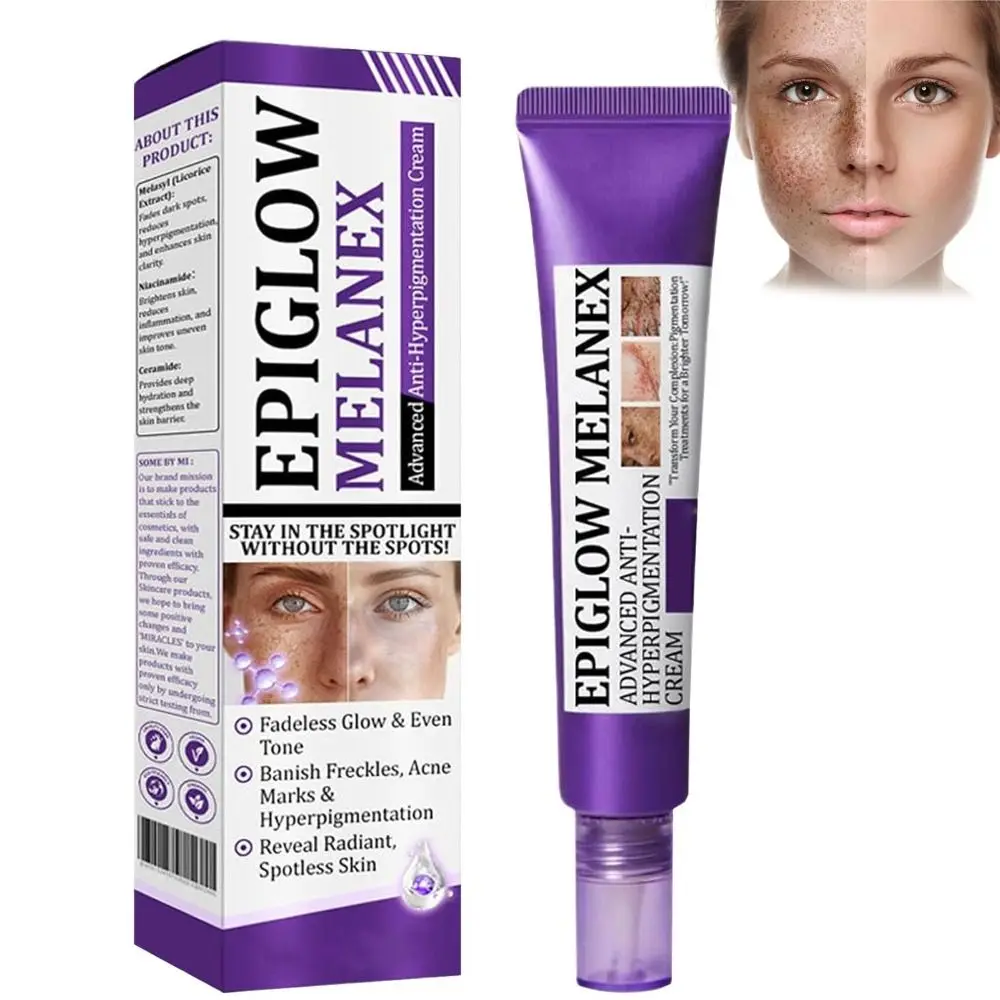 Diepe Reiniging Anti Hyperpigmentatie Crème Donkere Vlekken Remover Verhelderende Behandeling Gezichtscrème 20g Rimpel Remover Gezichtscrème