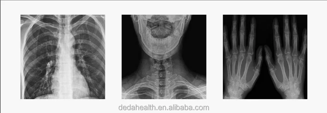 Hot Selling Product Iray Canis 2 Veterinary Hospital  Portable X-ray Machine Easy to Use Outdoors