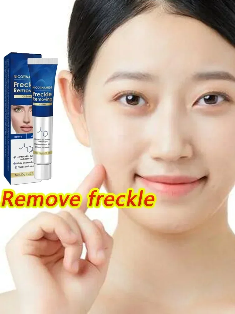 

Effictive Dark Spot Remover cream for Face Removing Freckle Melasma Chloasma Senile Plaques Sunburn Cyasma Chorioplaque Freckle