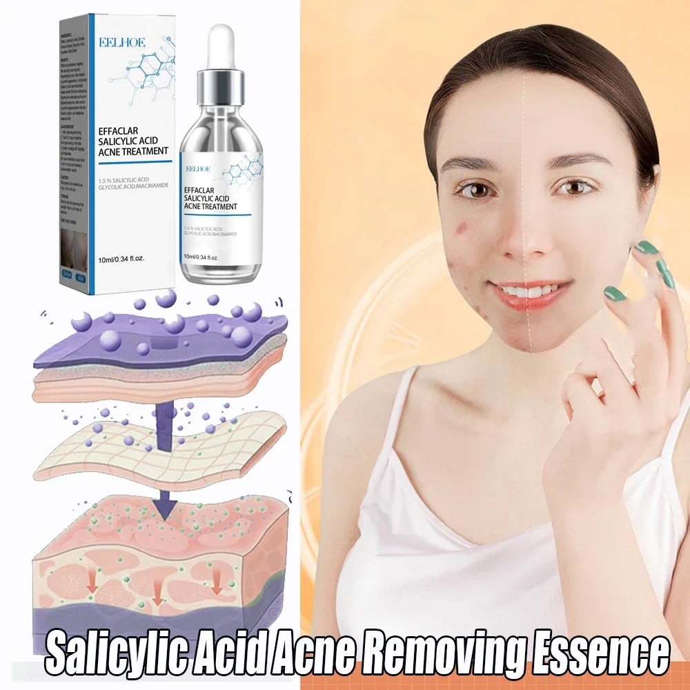 

Acne Serum, Professional Formula, Soothe Acne, Restore Healthy Skin Care, Diminish Acne Scars, Moisturize and Soothe