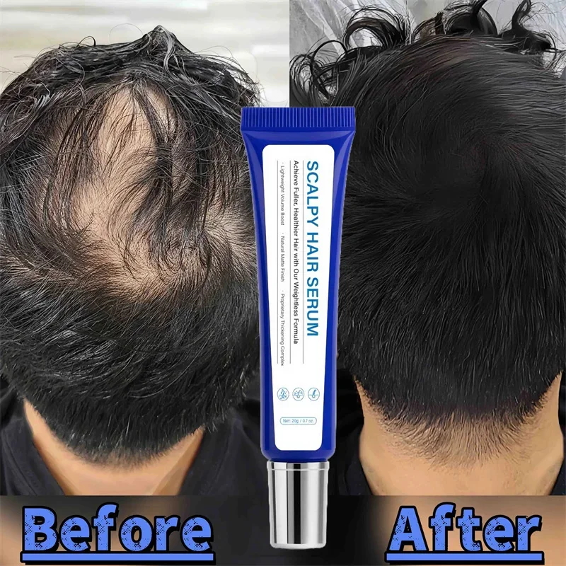 

Fast Hair Growth Oil Africa Crazy Traction Alopecia Serum Anti Hair Break Thicken Hair Loss Treatment Spray For Man Women 20ML