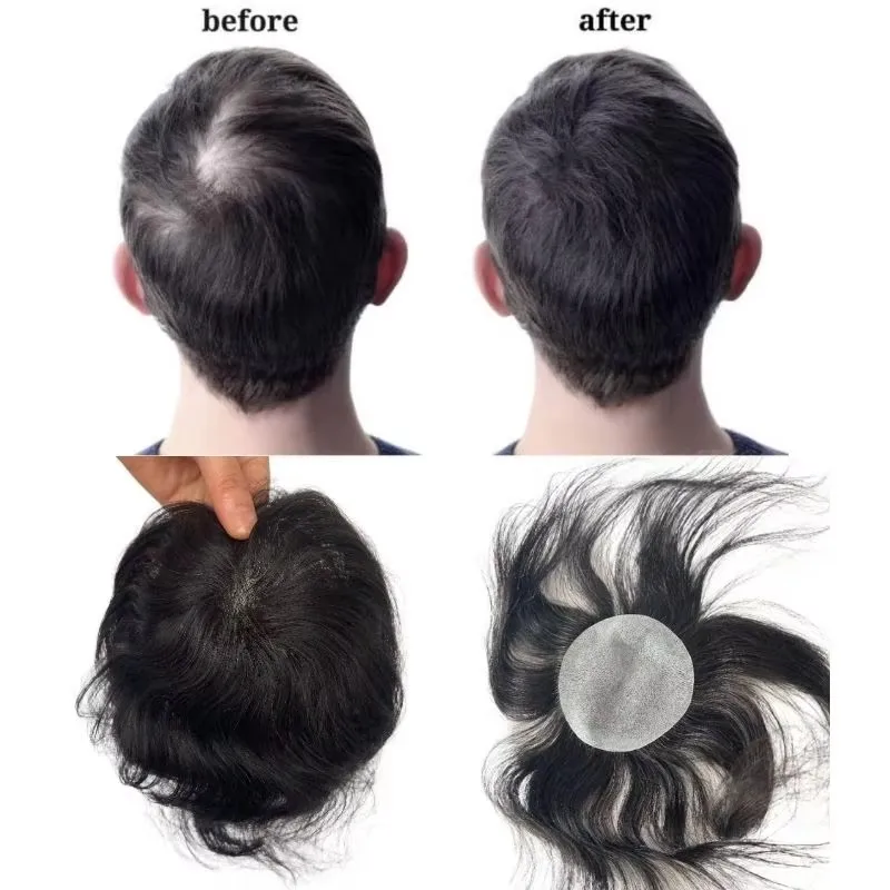 Thin Skin PU Bald Spot European Hair Patches Toupee for Men Dia. 8X8cm Hair Piece Glue On Hair Replacement System