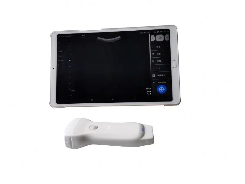 Double Probes Wireless Color Doppler Ultrasound Scanner Wifi Ultrasound