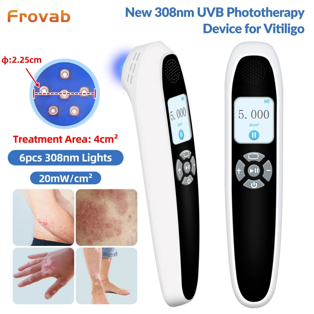 

Portable 6 Diodes 308nm Narrowband UVB Phototherapy Lamp Ultraviolet Light for Vitiligo White Spots Psoriasis Eczema Treatment