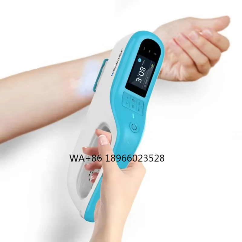 For  Psoriasis Vitiligo Treatment Latest Portable 308 Excimer  KN-5000E Targeted UVB Light Kernel  Excimer 308 nm