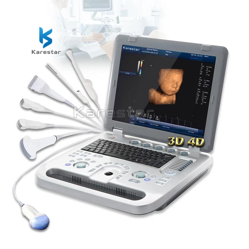 

Products subject to negotiationPortable Ultrasound Auto IMT Color Doppler Ultrasound Machine ecografo sonoscape