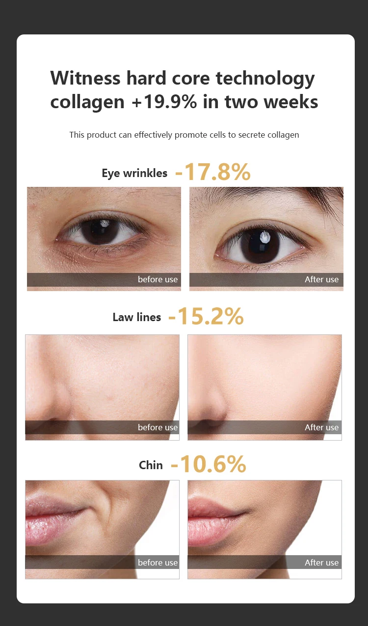 RF Facial Massager Facial Radiofrequency High Frequency Face Lifting Machine EMS Facial Microcurrent Lift Skin Tightening Device