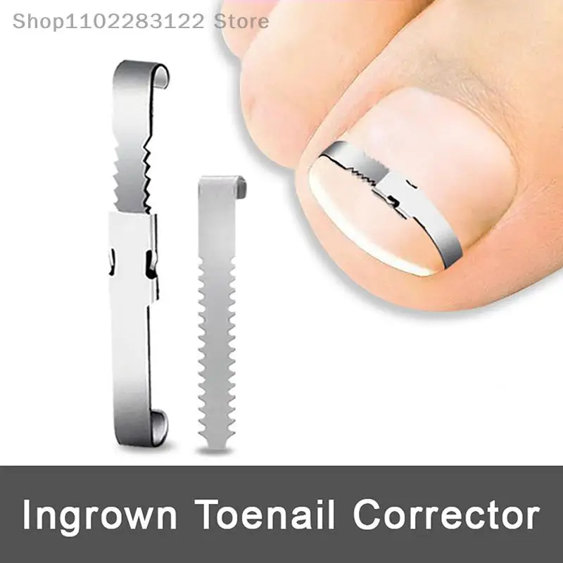 Ingrown Toenail Corrector Tools Pedicure Recover Embed Toe Nail Treatment Professional Foot Care Correction Tool