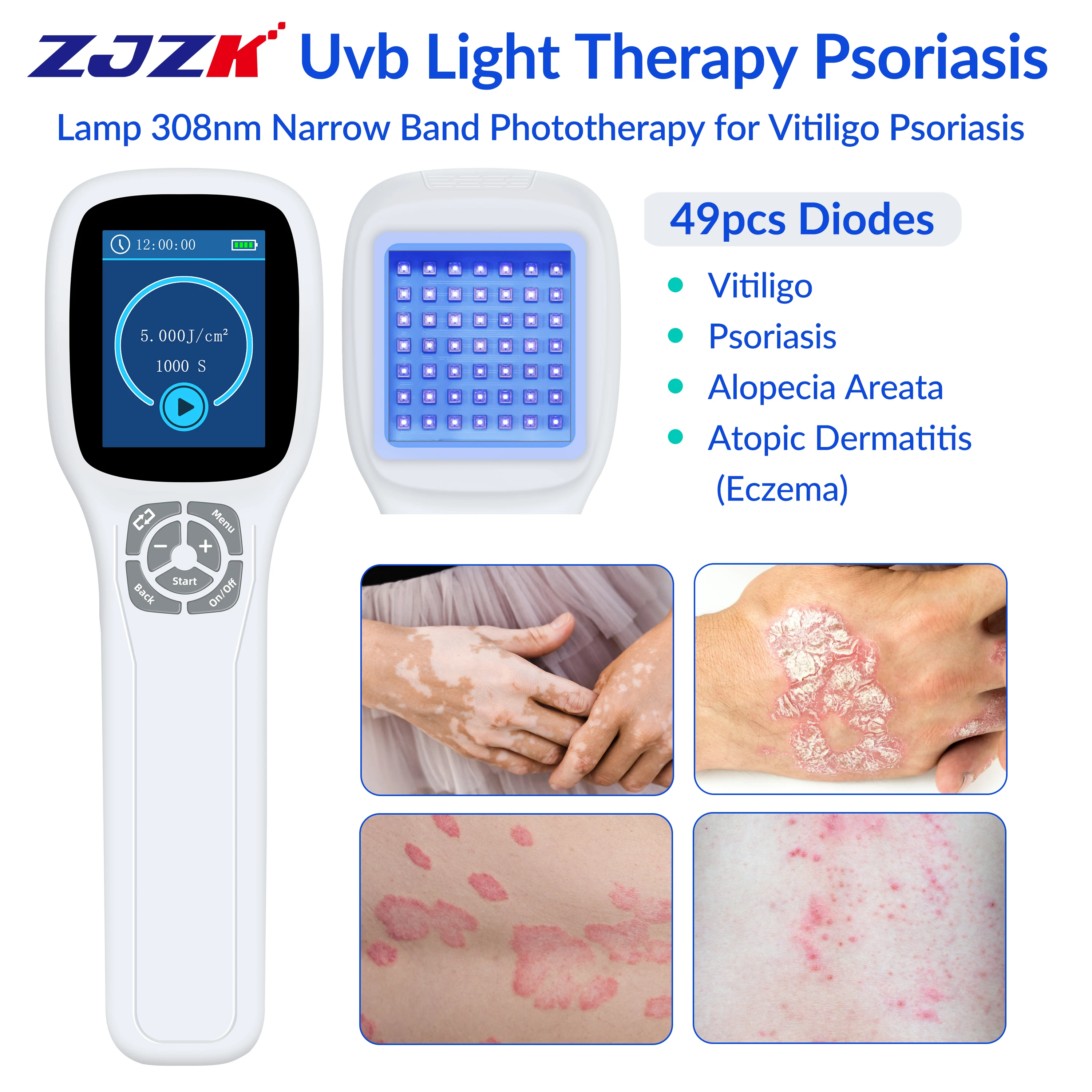2026 2026 Physiotherapy Ultraviolet Radiation Machine 308nm Excimer Phototherapy for Vitiligo Psoriasis Eczema Skin Diseases