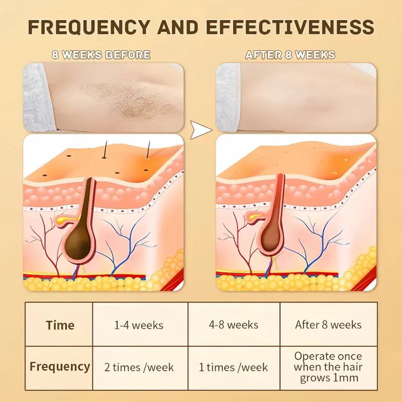 Swoson Professionele Permanente Laser Depilator Body Bikini IPL Ontharing Handset Thuisgebruik voor dames en heren