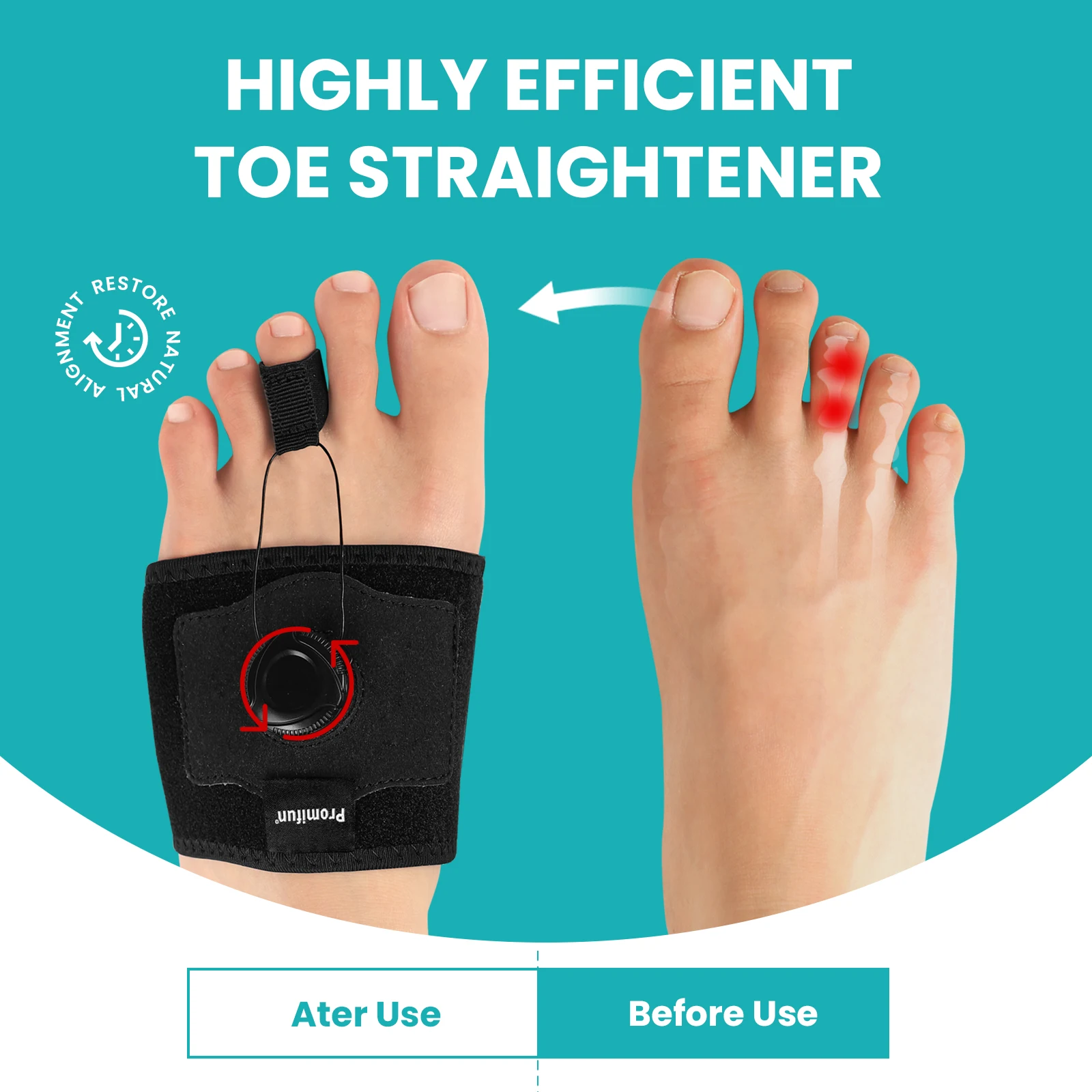 

1Pc Sumifun Hammer Toe Corrector Women Hammer Toe Straightener Corrector Crooked Toes Floating Toes One Hole Black Toe Separator