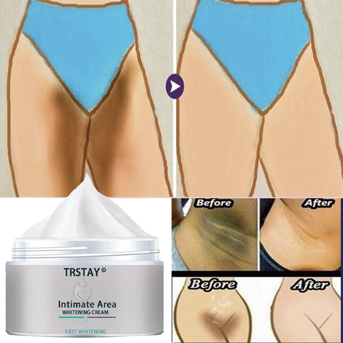 

Отбеливающий крем TRSTAY для частных зон - эффективное удаление местного пигментации, уход за кожей для беременных женщин