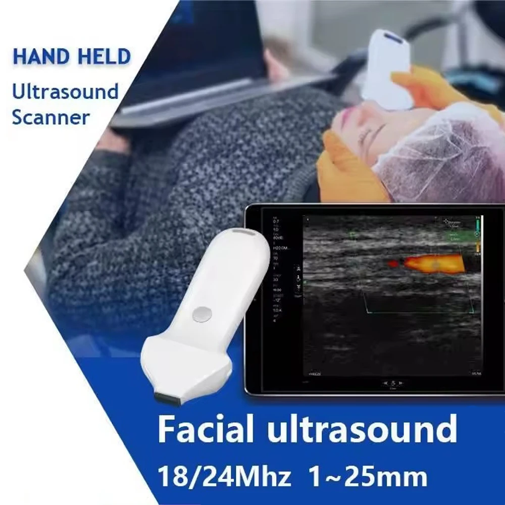 192 Elements Wireless Color Ultrasound Doppler Facial Ultrasound High Frequency Linear Probe Support IOS Android Windows.