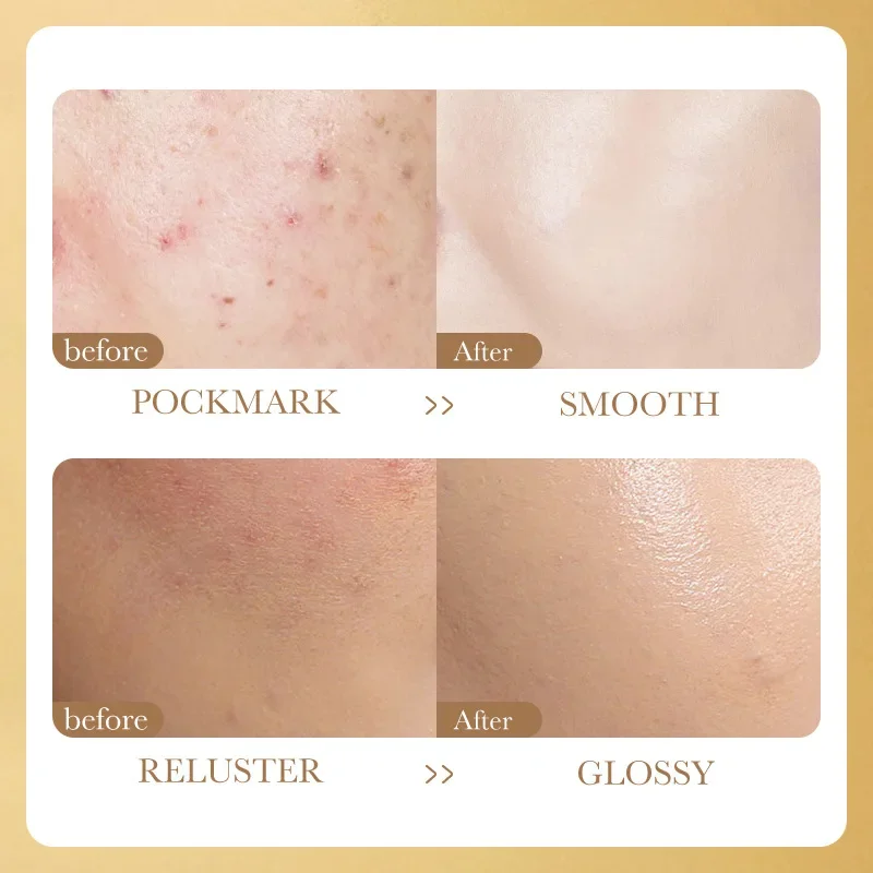 12pcs Nicotinamide Vitamin C Lyophilized Powder Set Anti-wrinkles Anti-aging Moisturizing Facial Serum Face Skin Care Sets