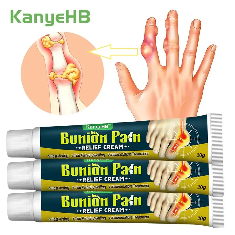 

3Pcs Bunion Pain Relieve Cream Treat Gout Hallux Valgus Corrector Ointment Toe Joint Swelling Ache Herbal Medical Plaster A1790