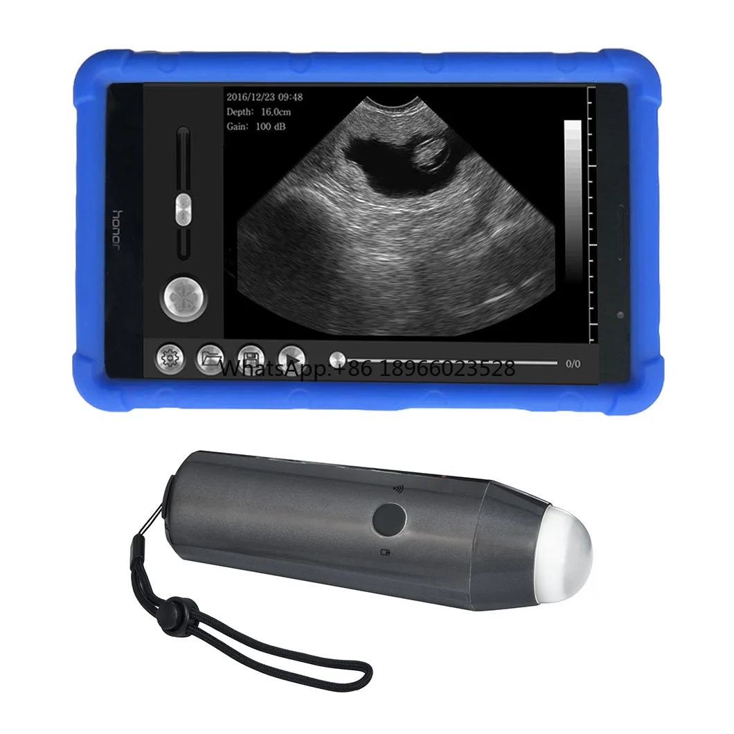 

WiFi Veterinary Waterproof Tablet-based Portable Ultrasound Probe for pig sheep goat fast pregnancy detection