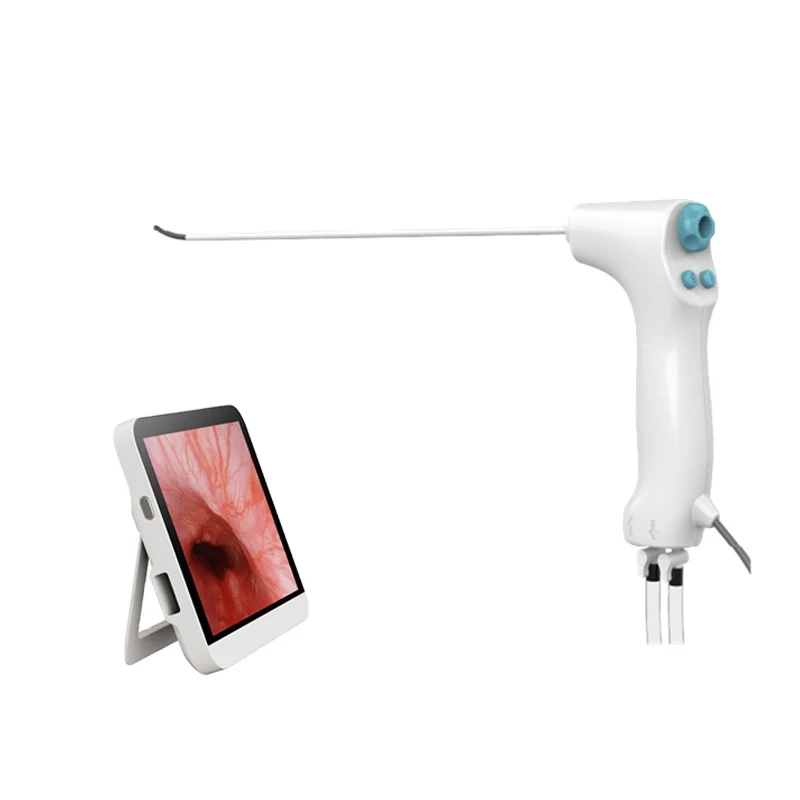 

Geyi Single Use Digital Flexible Video Disposable Hysteroscope Diagnostique Et Chirurgical Price