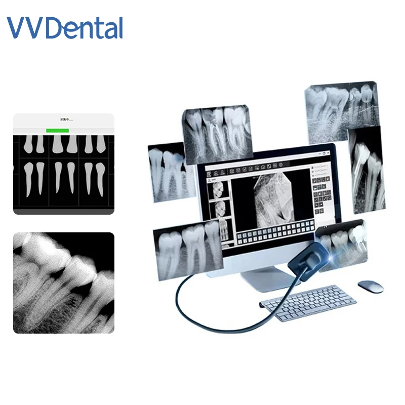 

VVDental Dental RVG Sensor Рентгеновский радиоизограф Высокочастотный цифровой датчик Система внутриротовой визуализации HD-изображение Стоматологические инструменты