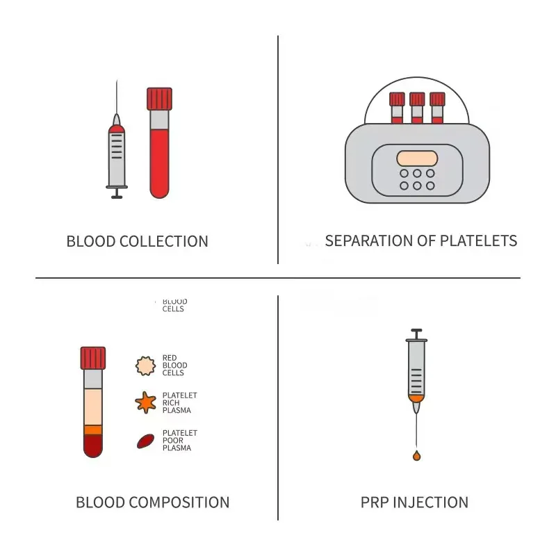 Prf Extraction Test…