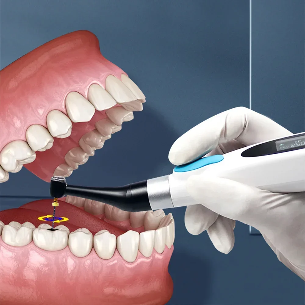 ELIJAH Tandheelkundige Endomotor 16:1 Contra Hoek Endodontische Oplaadbare Draadloze Wortelkanaalbehandeling Therapie Apparaat 9 Vooraf ingestelde
