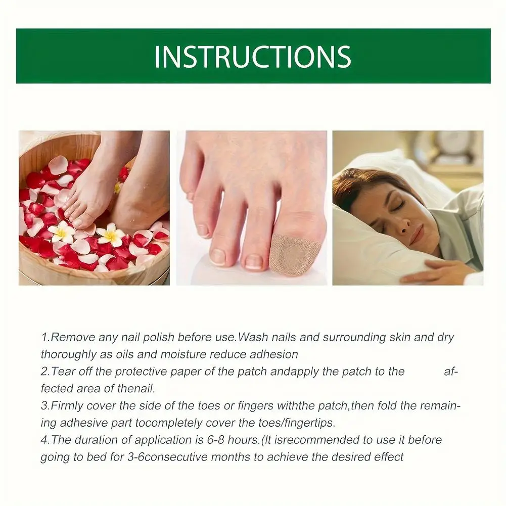 حار 72 قطعة مسمار القدم رقعة إصلاح الإطارات رمادي الفطرية مسمار رشاقته لينة بارونيشيا العدوى اليد مسمار تصحيح ملصق نام أظافر