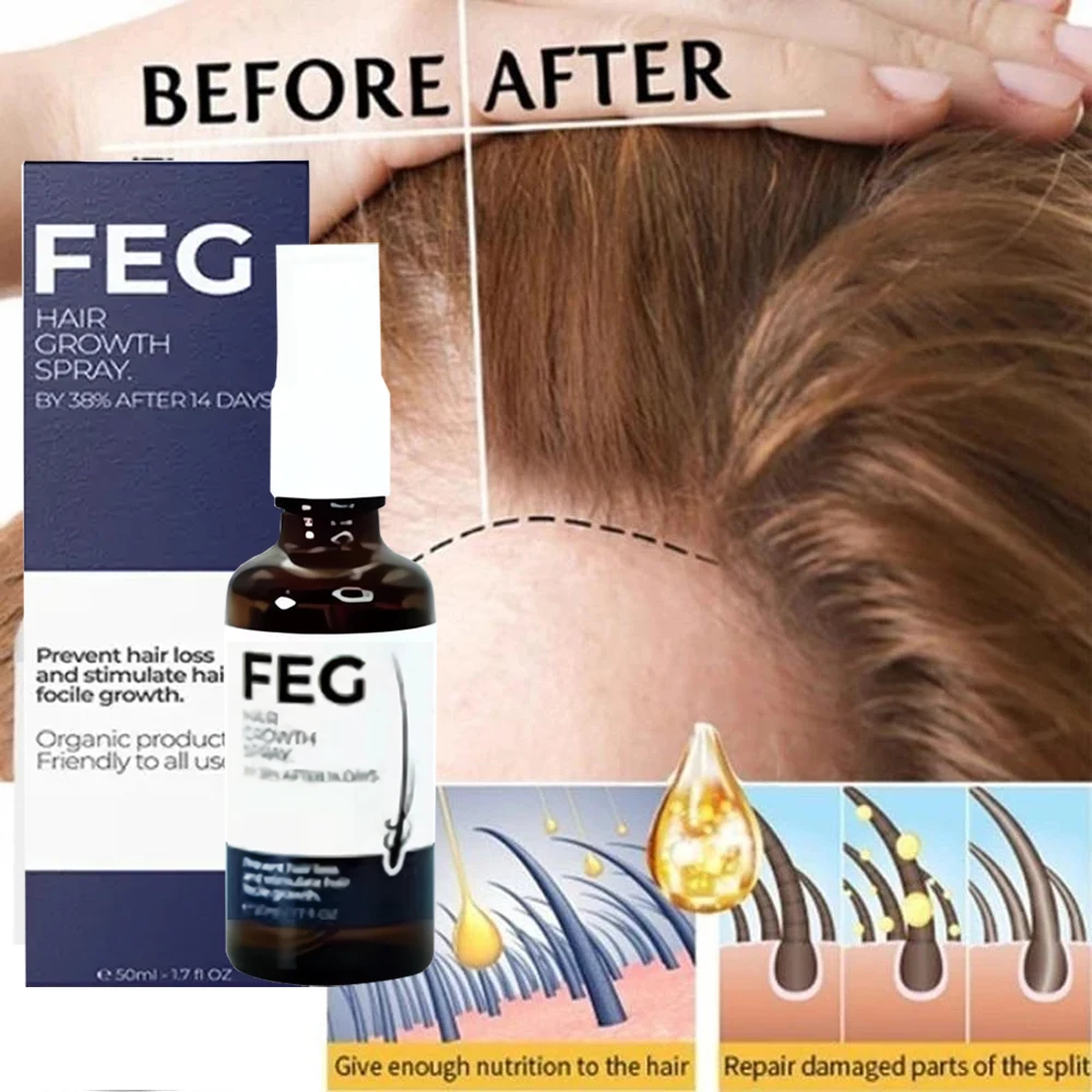 Best Hair Care Product FEG Hair Care Spray Serum For Hair Loss  50ml