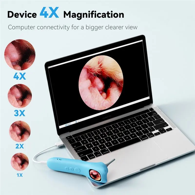 ABAG 1080P HD Otoscopio visivo digitale per orecchio 1.21 pollici Smart Visual Ear Wax Strumento pulito Supporto per scattare foto e video per l'orecchio del naso