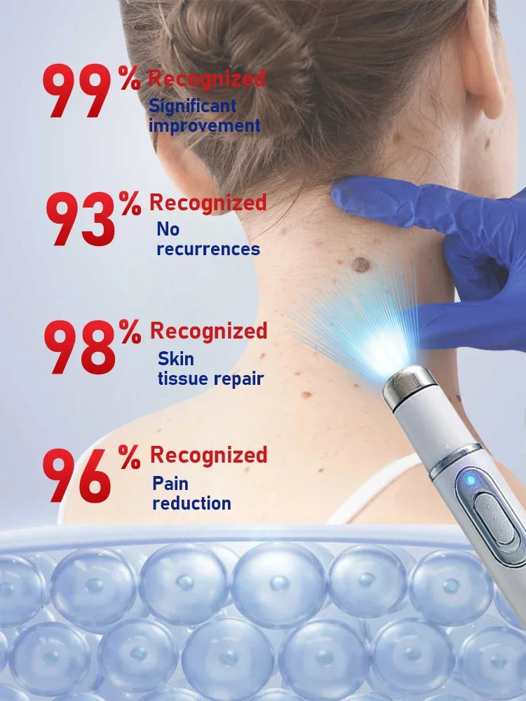 Thumbnail 4 - #64 Compare Foot Files Before You Buy