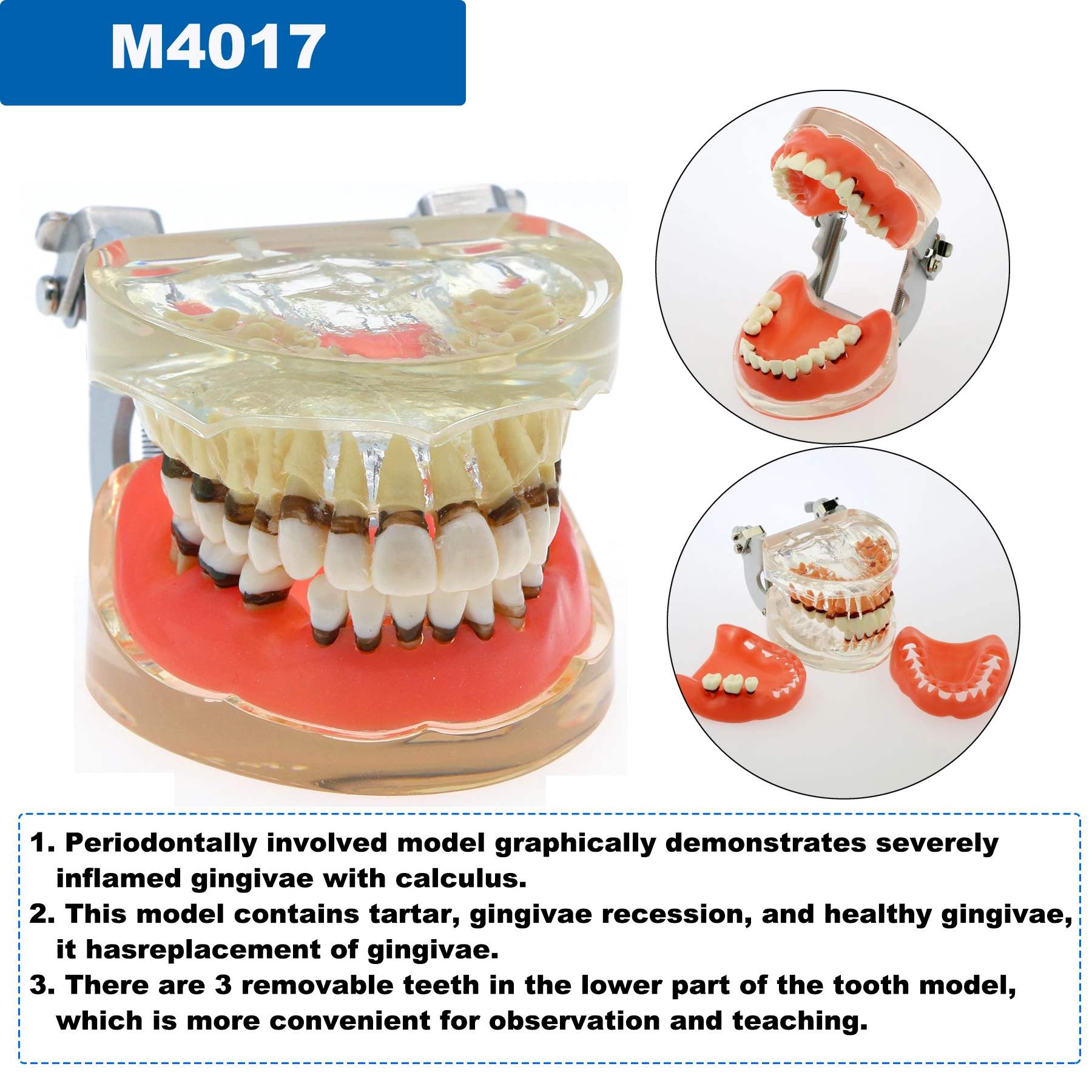 Standardowy Model dentystyczny Model zębów modelu patologicznego nauczania stomatologicznego ortodontycznego implantu przyzębia