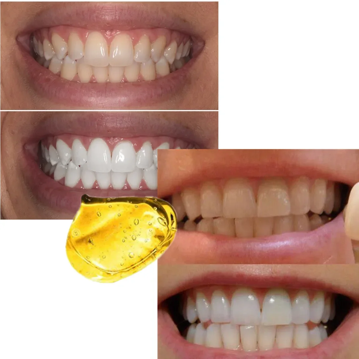 24K الذهب المهنية طبيب الأسنان مشرق الأبيض الأسنان تبييض الأسنان نظام تبييض هلام إزالة Staintools الأصفر