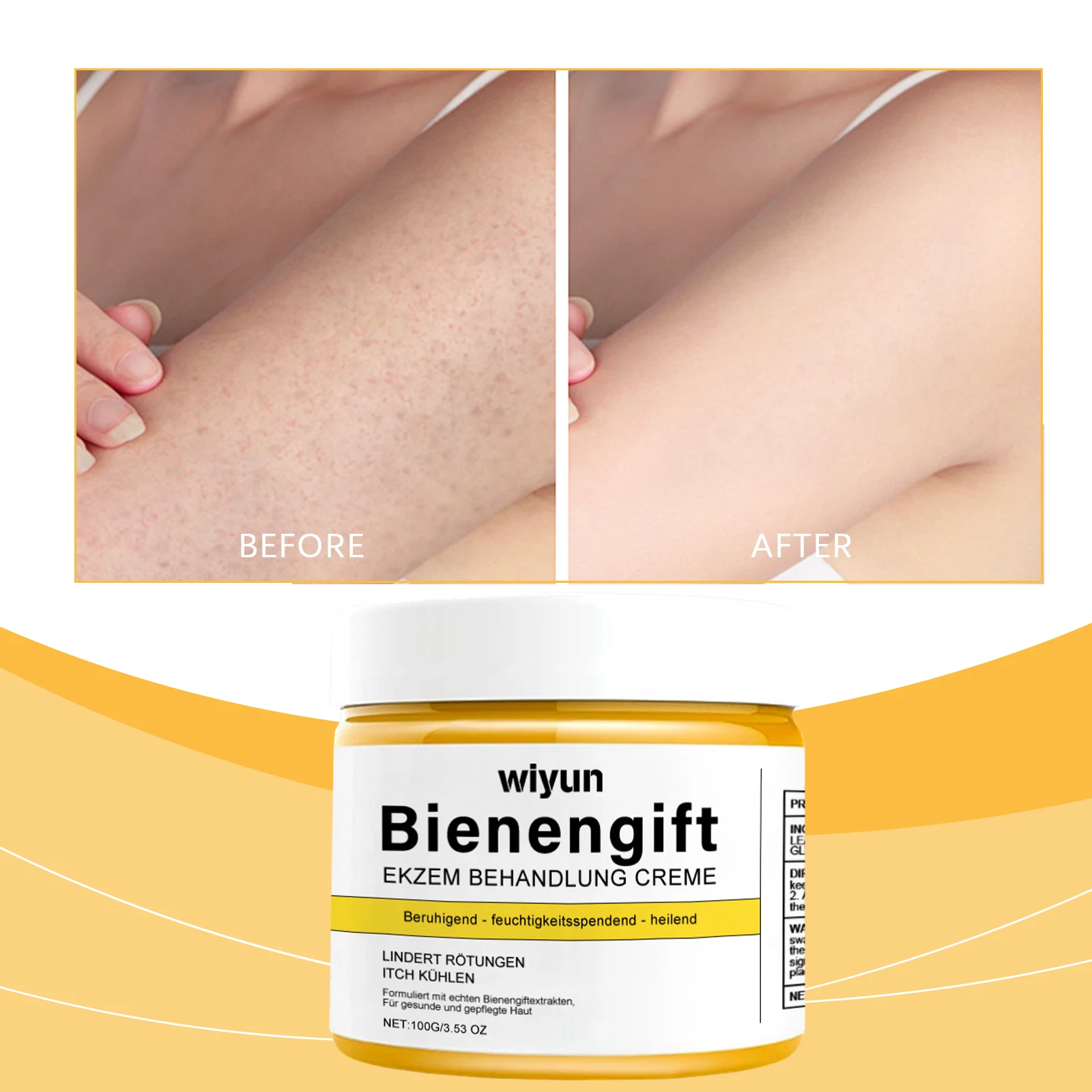 Crema per la cura della pelle al veleno d'api Crema idratante delicata lenitiva arrossamenti Crema idratante per la cura della pelle riparatrice