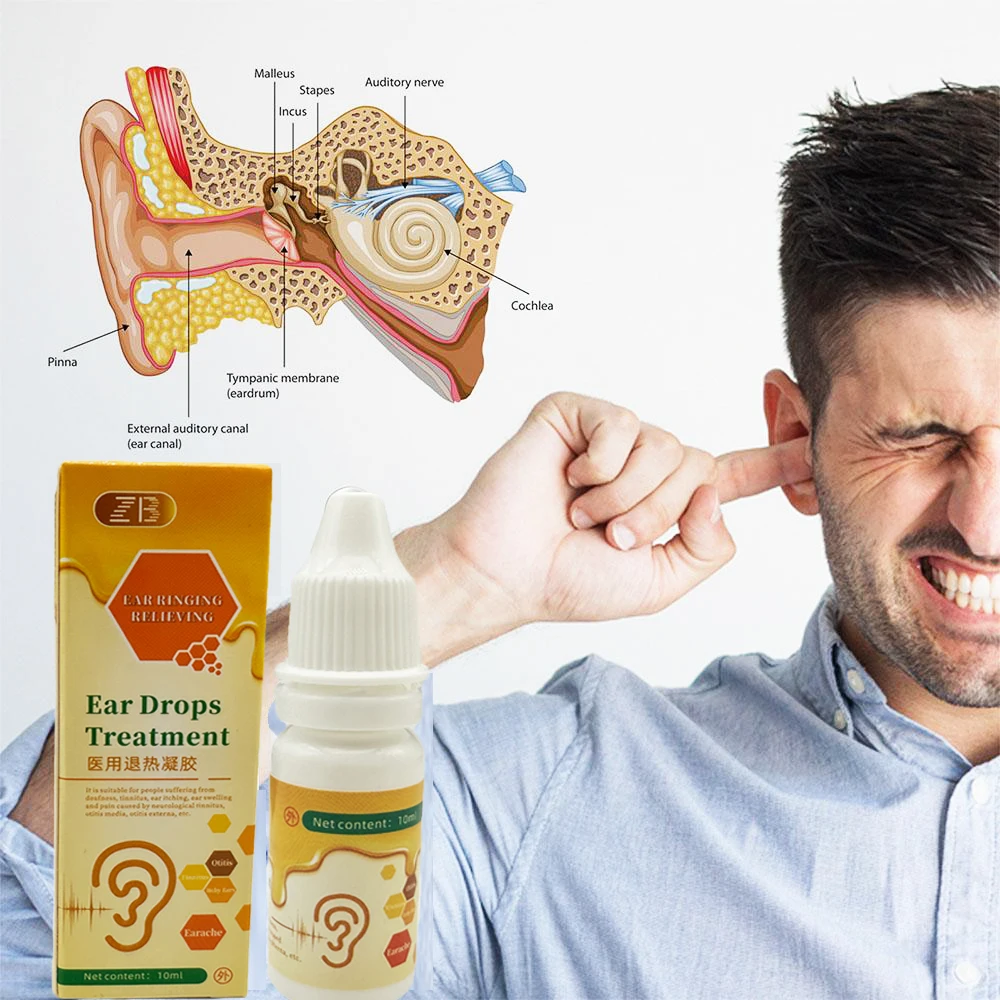 

ZB Otitis Media Cure ушные капли 10 мл ушной боли, зуд, острый Otitis, бактериальное лечение инфекций, очиститель ушной серы, капли для удаления