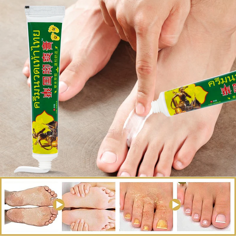 20g Thailand Foot Tinea Pedis Cream Treat Beriberi Medical Ointment Anti-itch Inhibits Fungus Peeling Athlete Foot Health Care