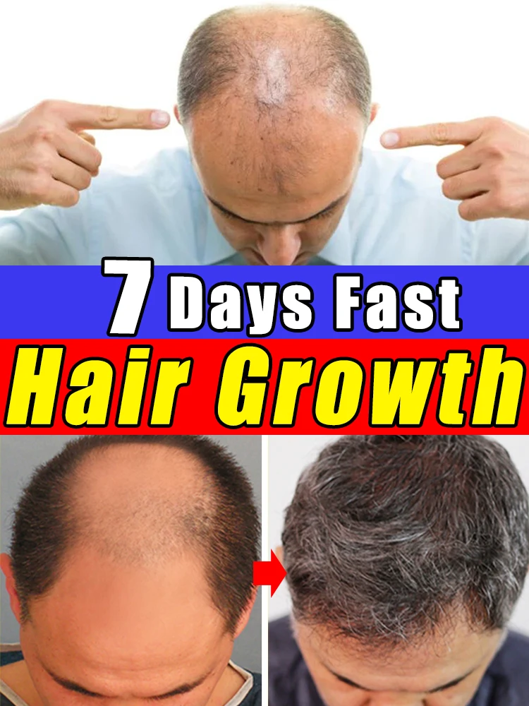 Rapid Hair Growth Conditioning Serum Treat Hairline Repair Damaged Hair Prevent Hair Loss Grow Hair Rapidly