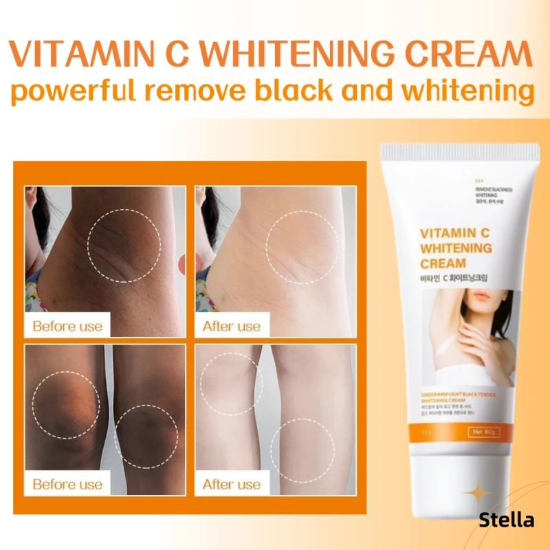 

Vitamin C Armpit Lightening Cream For Women Body Brightening Emulsion Private Parts Knuckles Bleaching Cream Korean Skin Care