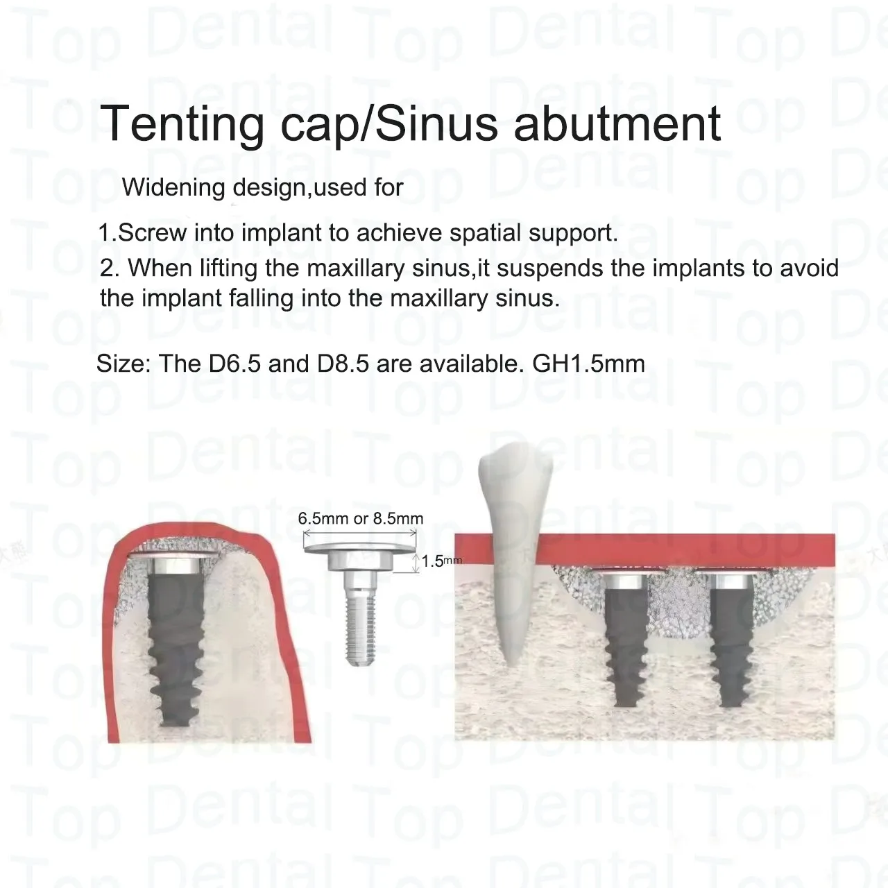 1 قطعة غطاء قاعدة الجيوب الأنفية للأسنان ملحقات زرع الجيوب الأنفية لـ OSSTEM Dentium Nobel ITI Adin #2