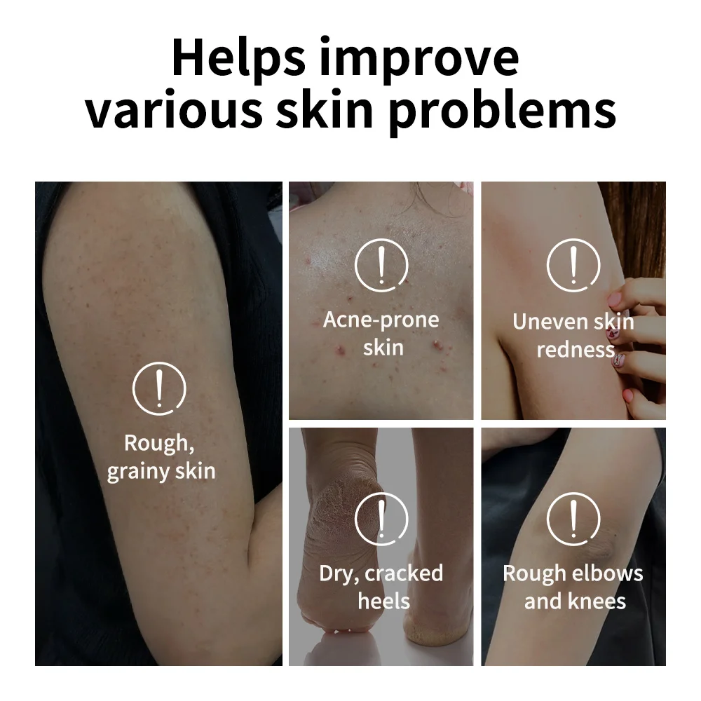 Lakerain Exfoliating Body Stick Multiple Glycolic Acid Cleaning Long-lasting Moisturizing Nourishing Smoothing Skin Care image 5