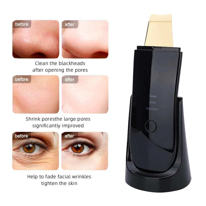 Ultrasonic Skin Scrubber IXP5 Waterproof Low Noise Light Therapy EMS Face Lifting Ultrasonic Face Cleaner Peeling Machine lesen