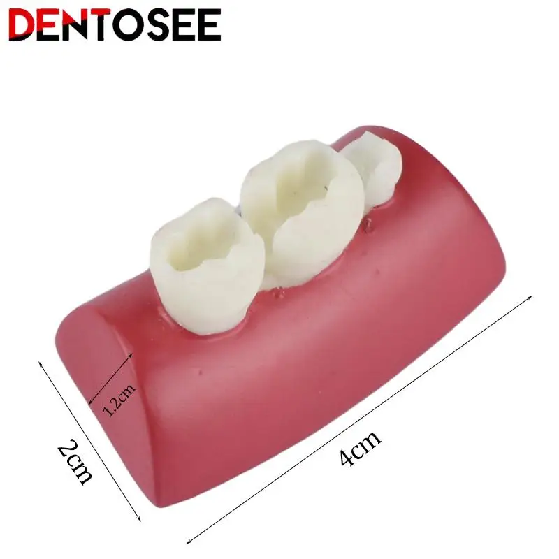 

Dental Inlay Exercise Model Block Filling Exercise Typodont Resin Materials for Dentistry Teaching Study