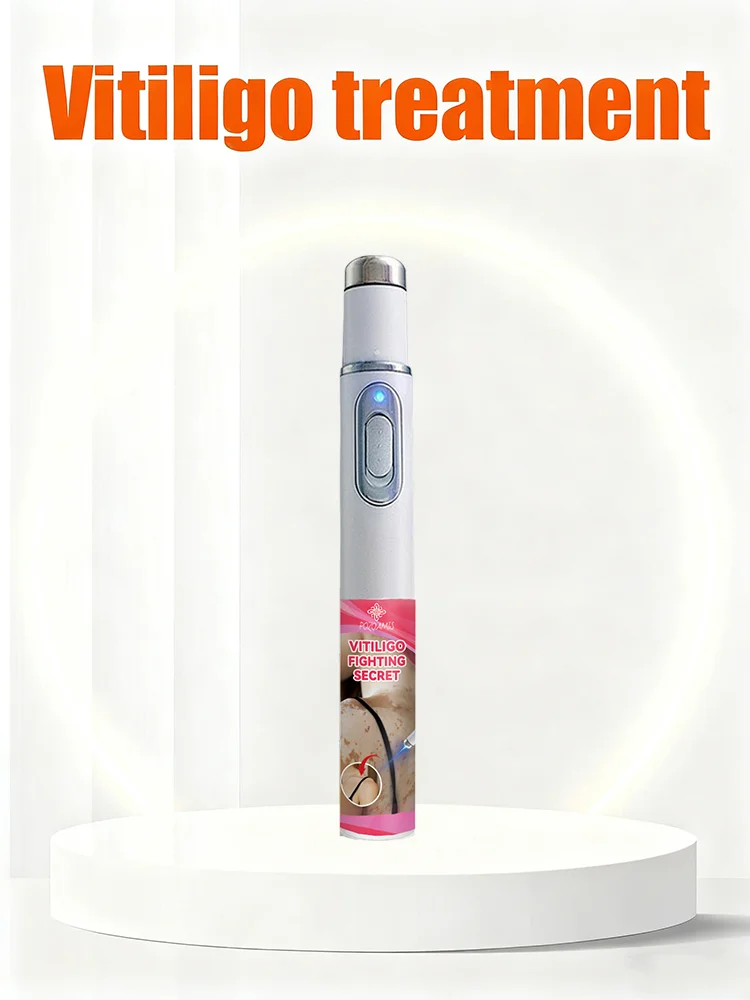 Generation-2 Laser Says Goodbye To Vitiligo In 7 Daysa