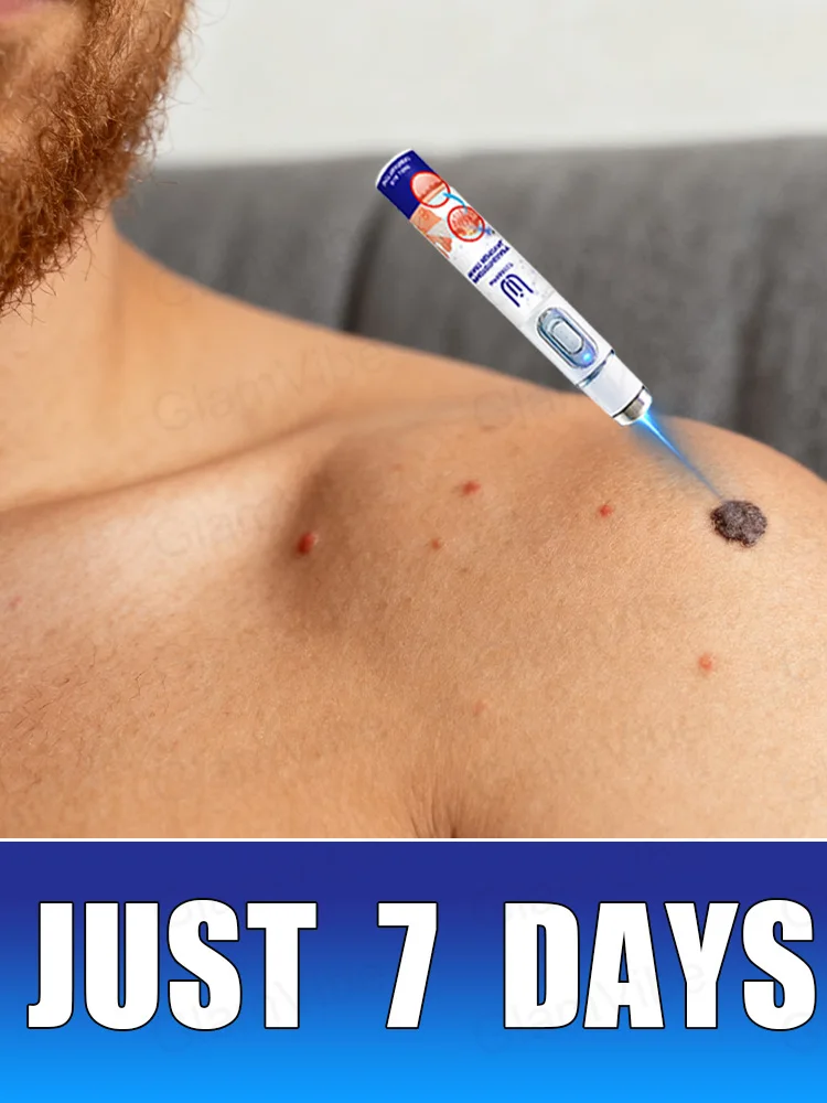 รุ่นที่ 2 ได้รับการอัปเกรด รักษาติ่งเนื้อ รักษาติ่งเนื้อที่เกิดจากราก ⸴ อย่างรวดเร็ว