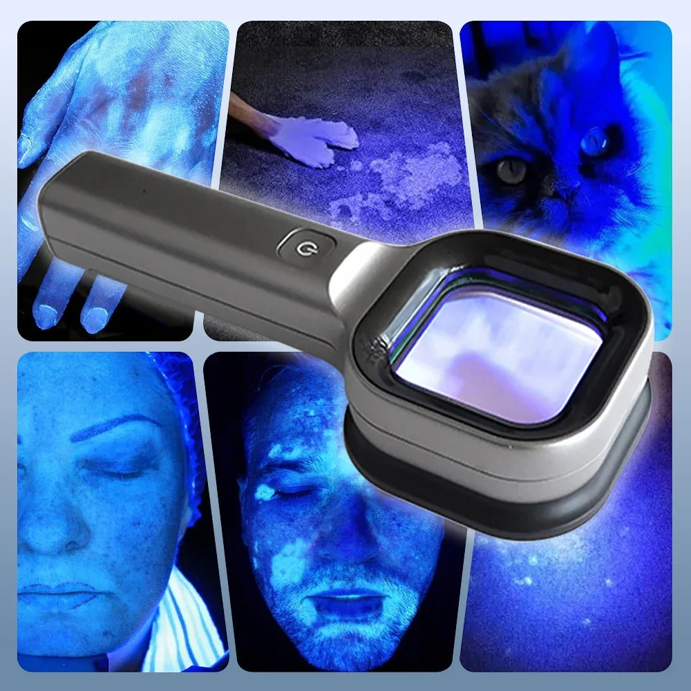 Lamp Skin Analyzer Portable Facial Salon Beauty Analyzer UV Handheld Lamp for Pet Cat and Dog Skin Detection Skin care