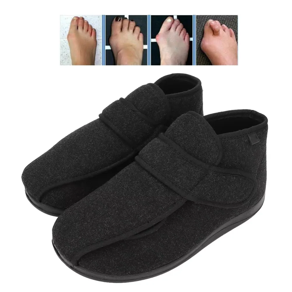 Medical Diabetic Slippers Adjustable Diabetic Elderly Eversion Deformation Hallux Valgus Correction Postoperative Recovery Shoes