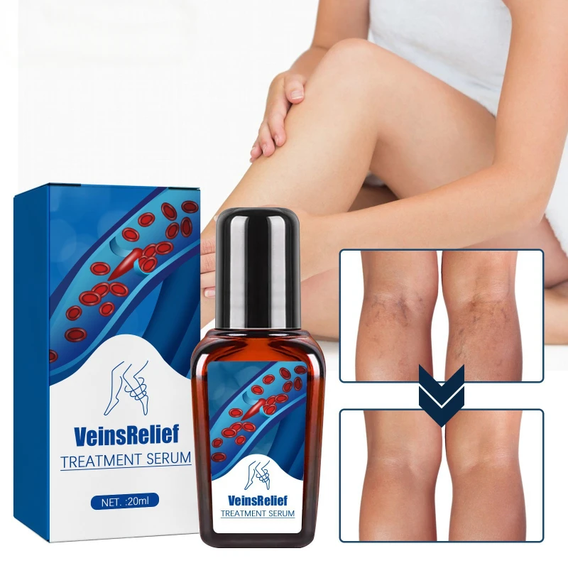 

Vein repair serum relieves leg varicose pain blue tendon bulge Eliminate Spider earthworm vasculitis phlebitis treatment liquid